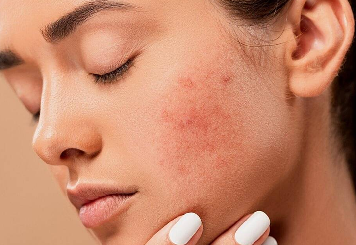 Hydora filtreli duş başlığı ile cilt dostu duş